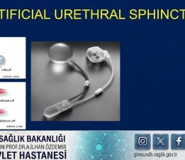 GİRESUN’DA SAĞLIKTA TARİHİ BAŞARI!
