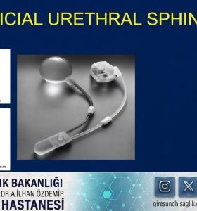 GİRESUN’DA SAĞLIKTA TARİHİ BAŞARI!